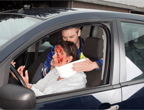 Auto Accidents Cause Most Head Injuries